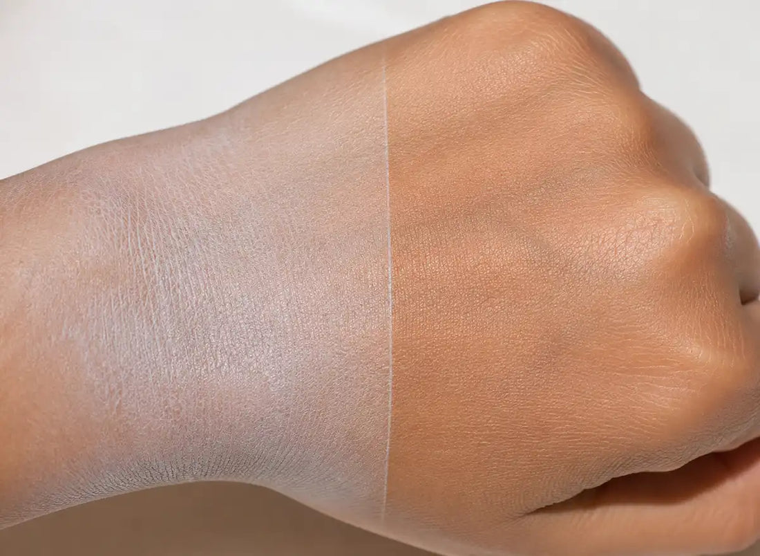 White Cast