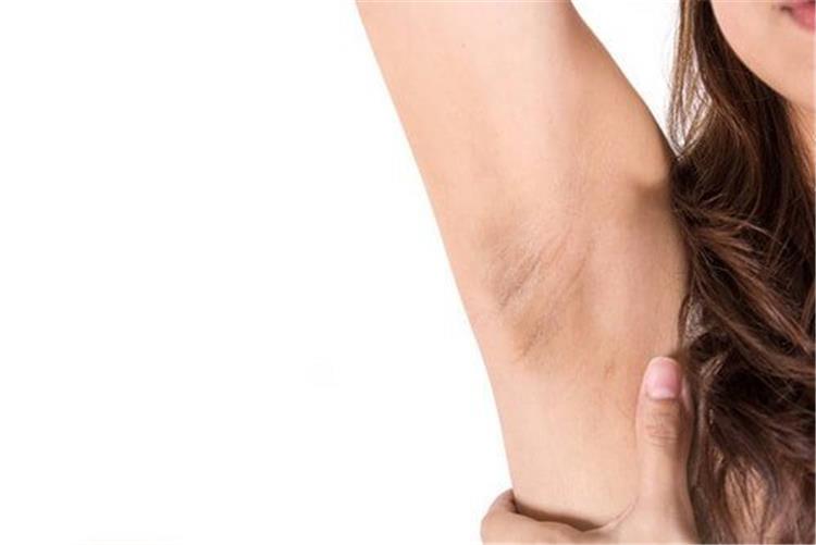اسمرار الإبط