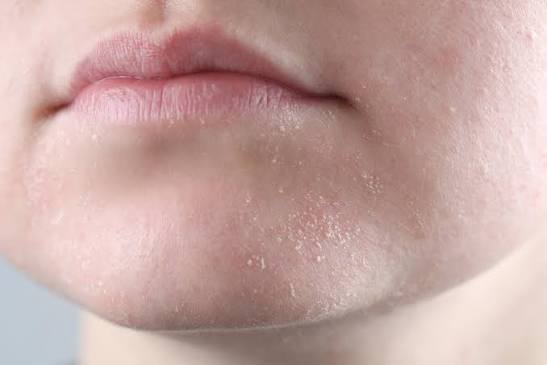 شد بعد غسل الوجه